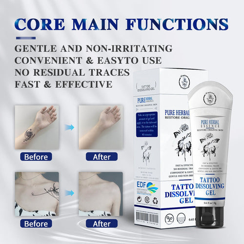 Tattoo Removal Cream - Fast and effective tattoo removal cream, permanent tattoo removal - skin pigment removal - painless - fast absorption - no scars