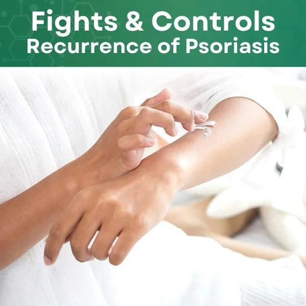 Psoriasis Treatment Cream